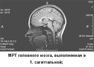 мрт головного мозга, процедуры мрт головы
