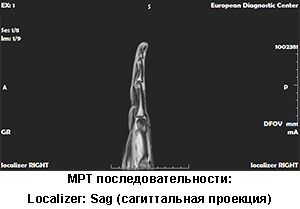 мрт руки, мрт кисти руки, мрт цена