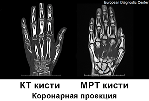 мрт кисти цена, мрт и кт, кт кисти