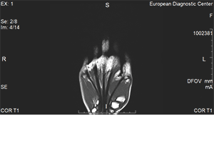 мрт кисти, мрт кисти руки, анатомия кисти